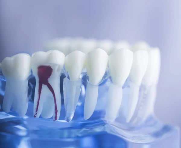 Modello di radice dentale — Foto Stock
