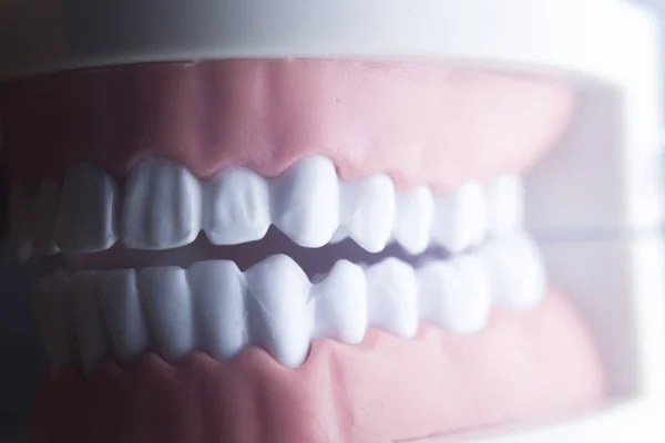 Model stomatologie zubní zuby — Stock fotografie