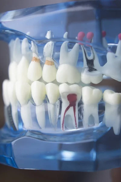 Модель стоматології зубів — стокове фото