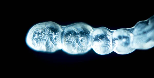 Ορθοδοντική οδοντιατρική τιράντες — Φωτογραφία Αρχείου