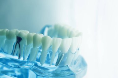 Diş diş diş hekimliği modeli