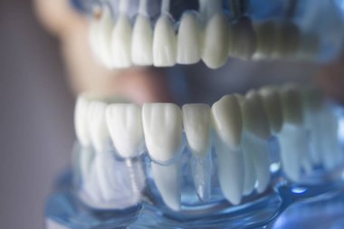 Diş diş diş hekimliği modeli