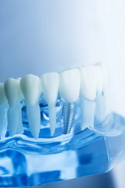 Modelo de odontología dental — Foto de Stock