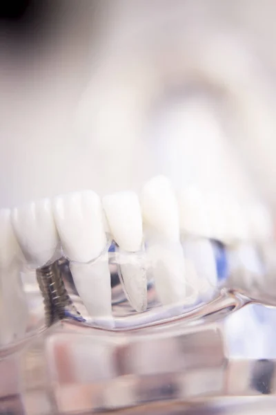 Zubaři zubní zuby model — Stock fotografie