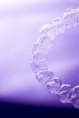 Görünmez aligners diş hizmetli