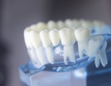 Diş diş diş hekimliği modeli