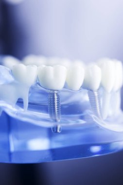 Diş diş diş hekimliği modeli