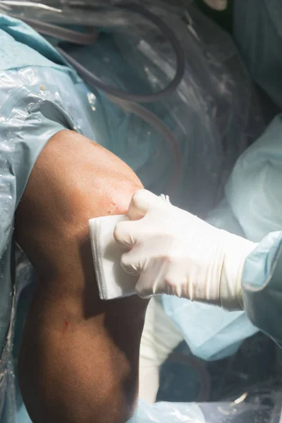 Knie-Operation Krankenschwester Verband — Stockfoto