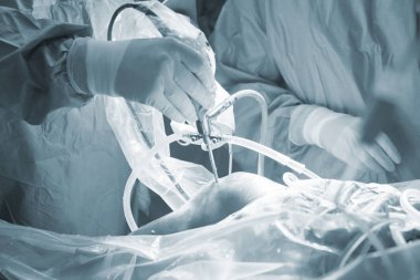 Diz cerrahisi Hastanesi işlemi