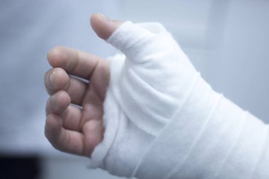 Doktor hasta alçı
