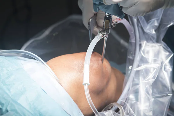 Операція в госпіталі коліна — стокове фото