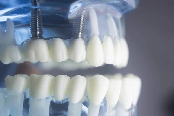 Dentystyczny zęby Stomatologia modelu — Zdjęcie stockowe
