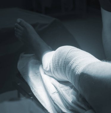 Diz ameliyatı hemşire sarmak