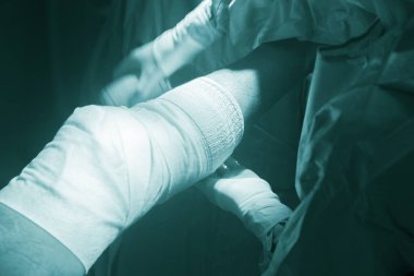 Diz ameliyatı hemşire sarmak