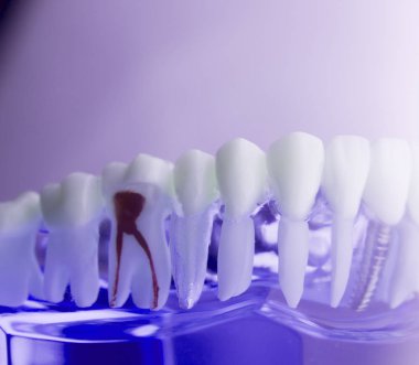 Diş diş diş hekimliği modeli