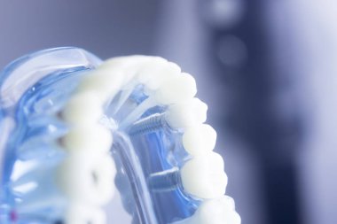 Diş diş diş hekimliği modeli