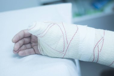 Doktor hasta alçı