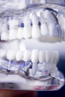 Diş hekimleri diş diş modeli