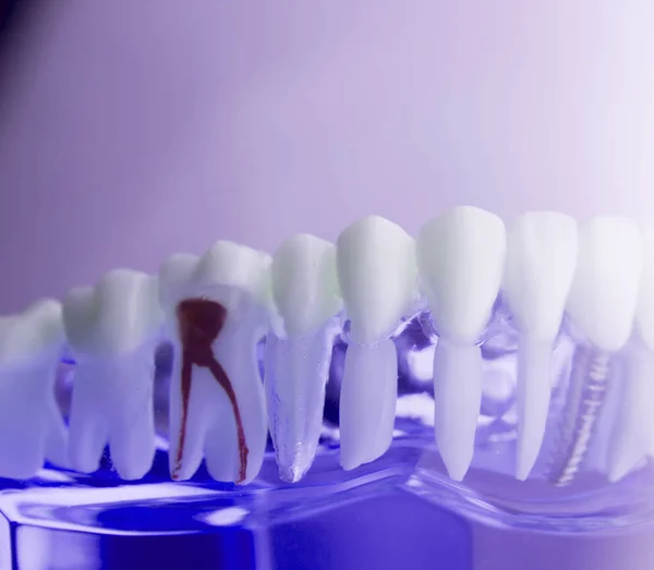 Modelo de odontología dental — Foto de Stock