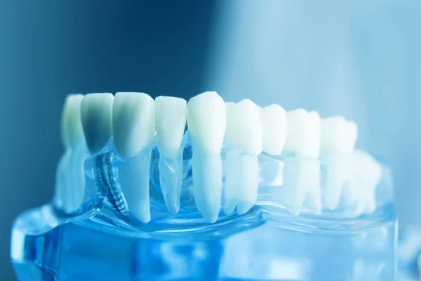 Dentystyczny zęby Stomatologia modelu — Zdjęcie stockowe