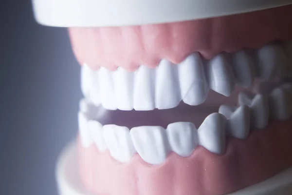 Modello di odontoiatria dentale — Foto Stock