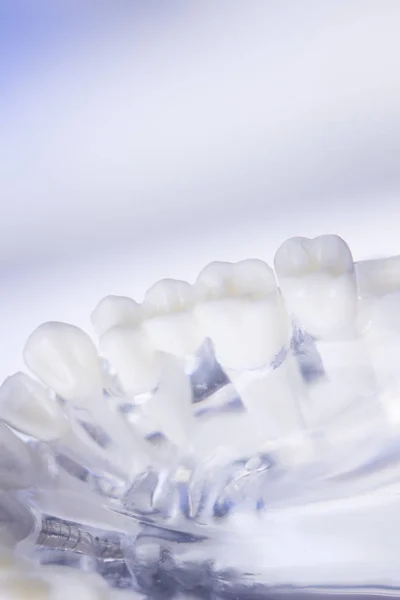Dentists dental teeth model — Stock Photo, Image