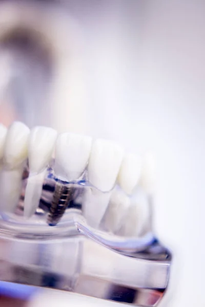 Tandartsen tandheelkundige tanden model — Stockfoto