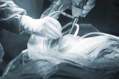 Diz cerrahisi Hastanesi işlemi