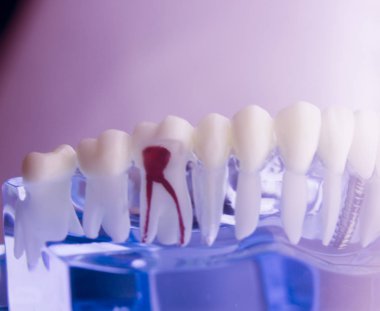 Diş diş diş hekimliği modeli