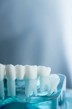 Diş diş diş hekimliği modeli