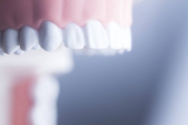 Diş diş diş hekimliği modeli