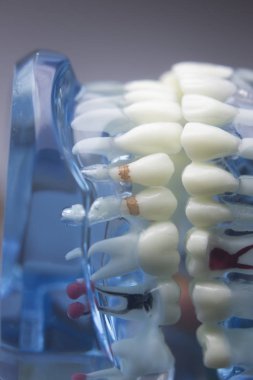 Diş diş diş hekimliği modeli