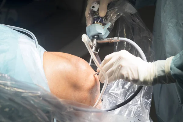 Cirugía de rodilla operación hospitalaria — Foto de Stock