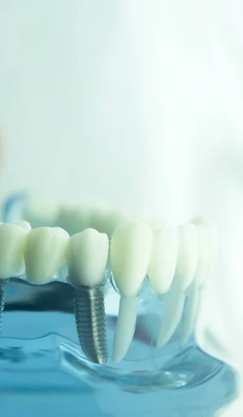 Modelo de odontología dental —  Fotos de Stock