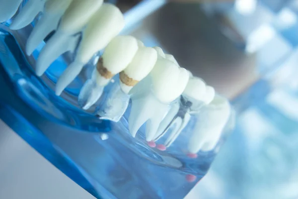 Modello di odontoiatria dentale — Foto Stock