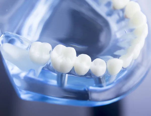 Dental teeth dentistry model — Stock Photo, Image