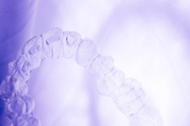 Görünmez aligner Diş telini