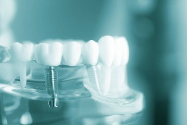 Diş diş diş hekimliği modeli