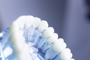 Diş diş diş hekimliği modeli