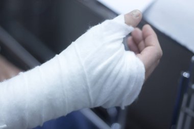 Doktor hasta alçı