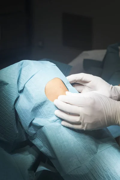 Cirugía de rodilla operación quirúrgica —  Fotos de Stock