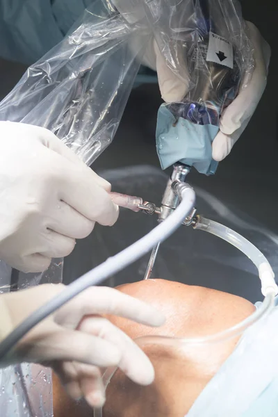 Knie operatie ziekenhuis operatie — Stockfoto