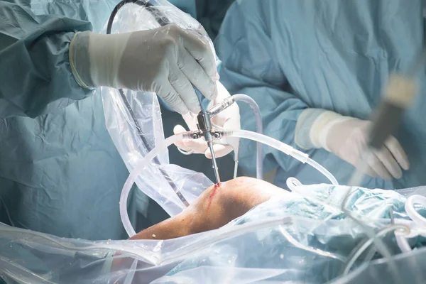 Knie-Operation im Krankenhaus — Stockfoto