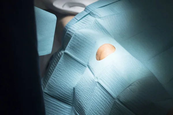 Cirugía de rodilla operación quirúrgica —  Fotos de Stock