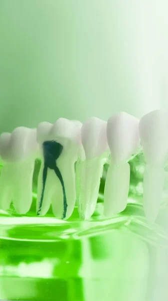 Modelo de odontología dental —  Fotos de Stock