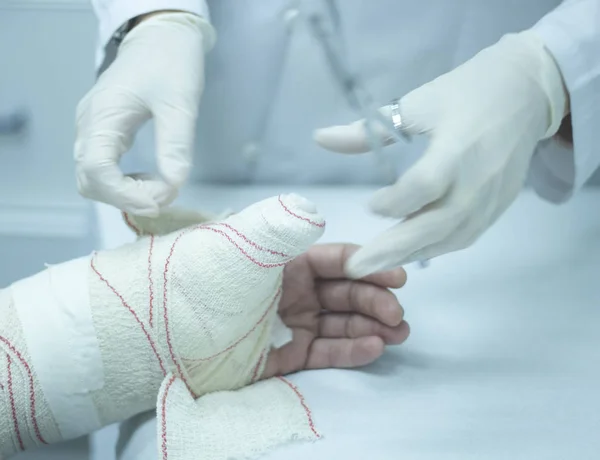 Läkare patienten gips cast — Stockfoto