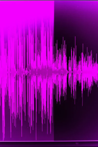 Hangfelvétel studio audio — Stock Fotó