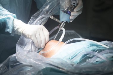 Diz cerrahisi Hastanesi işlemi