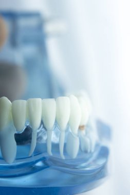 Diş diş diş hekimliği modeli