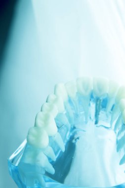 Diş diş diş hekimliği modeli